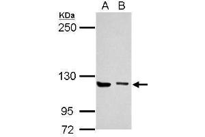 WB Image Sample (30 ug of whole cell lysate) A: Jurkat B: K562 5% SDS PAGE antibody diluted at 1:1000 (UNC13D anticorps  (C-Term))