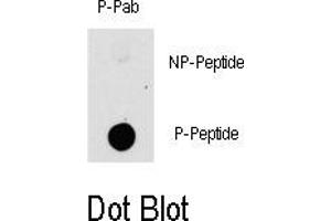 Image no. 1 for anti-P21-Activated Kinase 1 (PAK1) (pThr423) antibody (ABIN358352) (PAK1 anticorps  (pThr423))