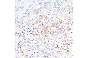Immunohistochemistry (IHC) image for anti-5'-Nucleotidase, Ecto (CD73) (NT5E) (AA 27-552) antibody (ABIN7449540)