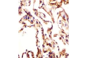 (ABIN652478 and ABIN2842325) staining AOC3 in human lung tissue sections by Immunohistochemistry (IHC-P - paraformaldehyde-fixed, paraffin-embedded sections).