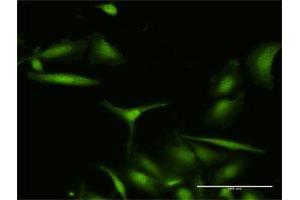 Immunofluorescence of purified MaxPab antibody to S100A7 on HeLa cell. (S100A7 anticorps  (AA 1-101))