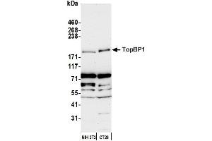 Western Blotting (WB) image for anti-Topoisomerase (DNA) II Binding Protein 1 (TOPBP1) (C-Term) antibody (ABIN7452107) (TOPBP1 anticorps  (C-Term))
