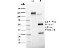 SDS-PAGE Analysis Purified CD11c Mouse Monoclonal Antibody (ITGAX/2507). (CD11c anticorps  (AA 637-827))