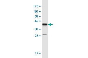 Western Blot detection against Immunogen (36. (SSX4 anticorps  (AA 91-188))
