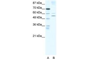 Western Blotting (WB) image for anti-Autoimmune Regulator (AIRE) antibody (ABIN2460527) (AIRE anticorps)