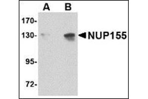 Western blot analysis of NUP155 in P815 cell lysate with this product at (A) 0.