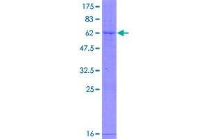 Image no. 1 for gamma-Glutamyl Hydrolase (Conjugase, Folylpolygammaglutamyl Hydrolase) (GGH) (AA 1-318) protein (GST tag) (ABIN1355048)