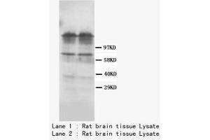 Image no. 1 for anti-Dopamine Receptor D1 (DRD1) (C-Term) antibody (ABIN1493058) (Dopamine Receptor d1 anticorps  (C-Term))