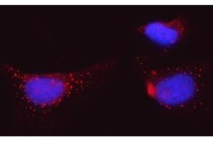 IF analysis of BI-1/TMBIM6 using anti-BI-1/TMBIM6 antibody (ABIN7603199).