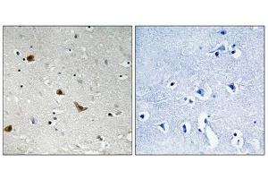 Immunohistochemical analysis of paraffin-embedded human brain tissue using IKK-γ (Phospho-Ser376) antibody (left)or the same antibody preincubated with blocking peptide (right).