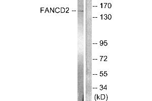 Western blot analysis of extracts from HT-29 cells, treated with Calyculin A (50ng/ml, 30mins), using FANCD2 (Ab-222) antibody (#B0427). (FANCD2 anticorps  (Ser222))