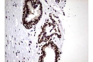 Image no. 7 for anti-Nibrin (NBN) (AA 183-460) antibody (ABIN1491058)