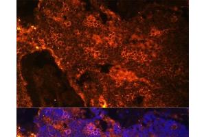 Immunofluorescence analysis of Rat bone marrow cells using SPTA1 Polyclonal Antibody at dilution of 1:100.