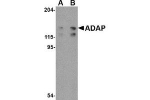 Western Blotting (WB) image for anti-FYN-Binding Protein (FYB) (C-Term) antibody (ABIN1030221)