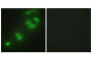Immunofluorescence analysis of HepG2 cells, using CREBZF antibody. (CREBZF anticorps)