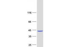 Validation with Western Blot
