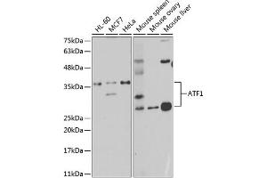 Western blot analysis of extracts of various cell lines, using  antibody (ABIN6127376, ABIN6137228, ABIN6137229 and ABIN6221472) at 1:1000 dilution. (AFT1 anticorps  (AA 1-210))