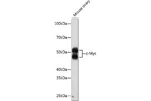 Western blot analysis of extracts of Mouse ovary, using c-Myc antibody (ABIN7268711) at 1:1000 dilution.