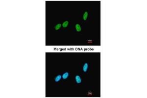 ICC/IF Image Immunofluorescence analysis of paraformaldehyde-fixed HeLa, using RED, antibody at 1:200 dilution.