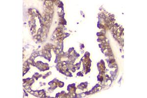 IHC analysis of Cyclophilin B using anti-Cyclophilin B antibody (ABIN6719475).