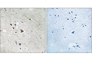 Immunohistochemistry analysis of paraffin-embedded human brain, using FLT3 (Phospho-Tyr969) Antibody. (FLT3 anticorps  (pTyr969))