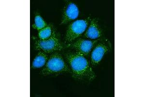 IF analysis of ASK1/MAP3K5 using anti-ASK1/MAP3K5 antibody (ABIN7600304). (ASK1 anticorps  (AA 178-1112))