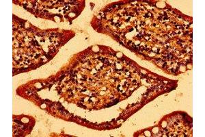 Immunohistochemistry of paraffin-embedded human small intestine tissue using ABIN7143170 at dilution of 1:100