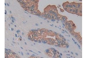 Detection of KLK10 in Human Prostate Tissue using Polyclonal Antibody to Kallikrein 10 (KLK10)