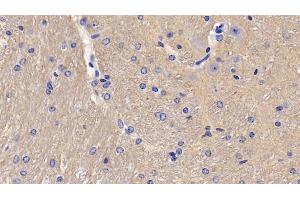Detection of CD90 in Mouse Cerebellum Tissue using Polyclonal Antibody to Cluster of Differentiation 90 (CD90) (CD90 anticorps  (AA 20-131))