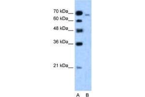 Western Blotting (WB) image for anti-Afadin (MLLT4) antibody (ABIN2460899) (Afadin anticorps)