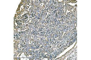 IHC analysis of ATG16L1 using anti-ATG16L1 antibody (ABIN7602244). (ATG16L1 anticorps  (AA 66-359))