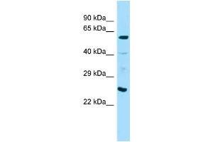 Western Blotting (WB) image for anti-Angiopoietin 1 (ANGPT1) (C-Term) antibody (ABIN2789373) (Angiopoietin 1 anticorps  (C-Term))