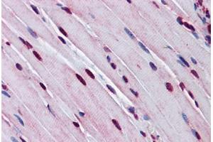 Mouse Skeletal Muscle: Formalin-Fixed, Paraffin-Embedded (FFPE) (TTF1 anticorps  (AA 51-100))