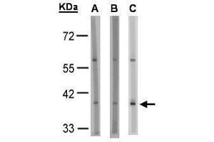 WB Image Sample(30 μg of whole cell lysate) A:HeLa S3 , B:MOLT4, C:Raji , 10% SDS PAGE antibody diluted at 1:1000 (SUCNR1 anticorps)
