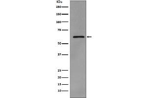 Western blot analysis of Phospho-Src (Y419) expression in A431 cell lysate treated with pervanadate.