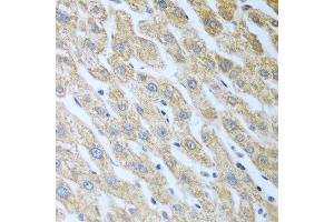 Immunohistochemistry of paraffin-embedded human liver using Eif2ak2 antibody.