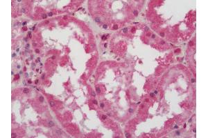 Human Kidney: Formalin-Fixed, Paraffin-Embedded (FFPE)