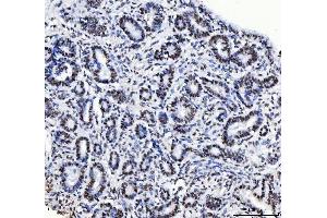 IHC analysis of CPSF6 using anti-CPSF6 antibody (ABIN7601897).