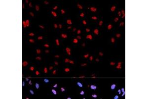Immunofluorescence analysis of U2OS cells using Phospho-MEF2C(S396) Polyclonal Antibody (MEF2C anticorps  (pSer396))