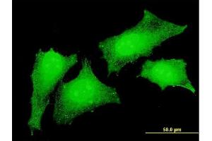 Immunofluorescence of monoclonal antibody to CRKL on HeLa cell.