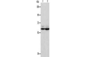 Gel: 8 % SDS-PAGE, Lysate: 40 μg, Lane 1-2: Hela cells, Jurkat cells, Primary antibody: ABIN7130740(PSMD3 Antibody) at dilution 1/300, Secondary antibody: Goat anti rabbit IgG at 1/8000 dilution, Exposure time: 5 seconds (PSMD3 anticorps)