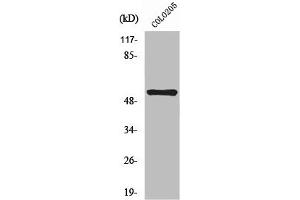 Western Blot analysis of COLO205 cells using NK-3R Polyclonal Antibody (TACR3 anticorps  (C-Term))