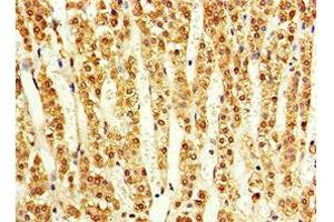 Immunohistochemistry of paraffin-embedded human adrenal gland tissue using ABIN7143179 at dilution of 1:100 (ACVR1C/ALK7 anticorps  (AA 22-113))