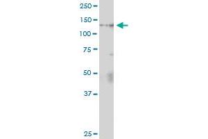Immunoprecipitation of ZHX1 transfected lysate using anti-ZHX1 MaxPab rabbit polyclonal antibody and Protein A Magnetic Bead , and immunoblotted with ZHX1 purified MaxPab mouse polyclonal antibody (B01P) .