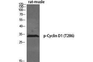 Western Blot (WB) analysis of specific cells using Phospho-Cyclin D1 (T286) Polyclonal Antibody.