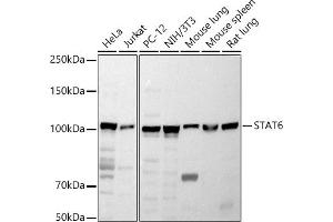 Western blot analysis of extracts of various cell lines, using ST antibody (ABIN6128541, ABIN6148581, ABIN6148582 and ABIN6213980) at 1:1000 dilution. (STAT6 anticorps  (AA 1-180))