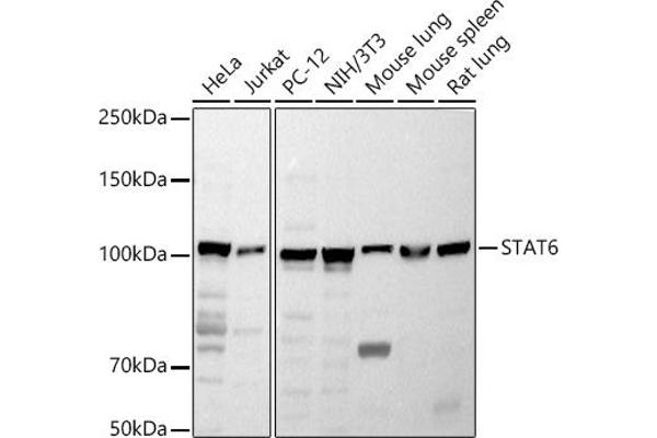 STAT6 anticorps  (AA 1-180)