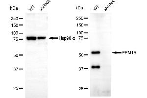 Western blotting analysis using PPM1B antibody (ABIN7800033). (PPM1B anticorps)