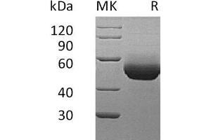 Western Blotting (WB) image for Interleukin 5 Receptor, alpha (IL5RA) (Active) protein (His tag) (ABIN7320600)