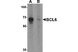 Western blot analysis of BCL6 in rat lung tissue lysate with Bcl6 antibody at 1 µg/mL in (A) the absence and (B) the presence of blocking peptide (BCL6 anticorps  (Middle Region))